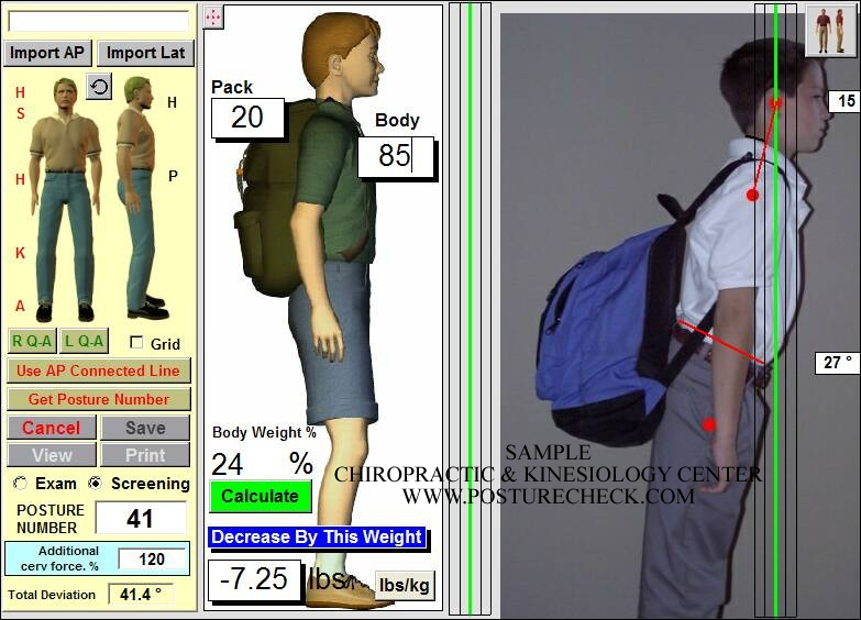 CHILDRENS BACKPACKS AND POSTURE